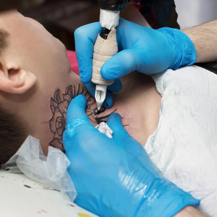 Tattoo removal treatment explanation at Varadhi Hair N Glow Hair Transplant & Skin Laser Clinic, Vijayawada
